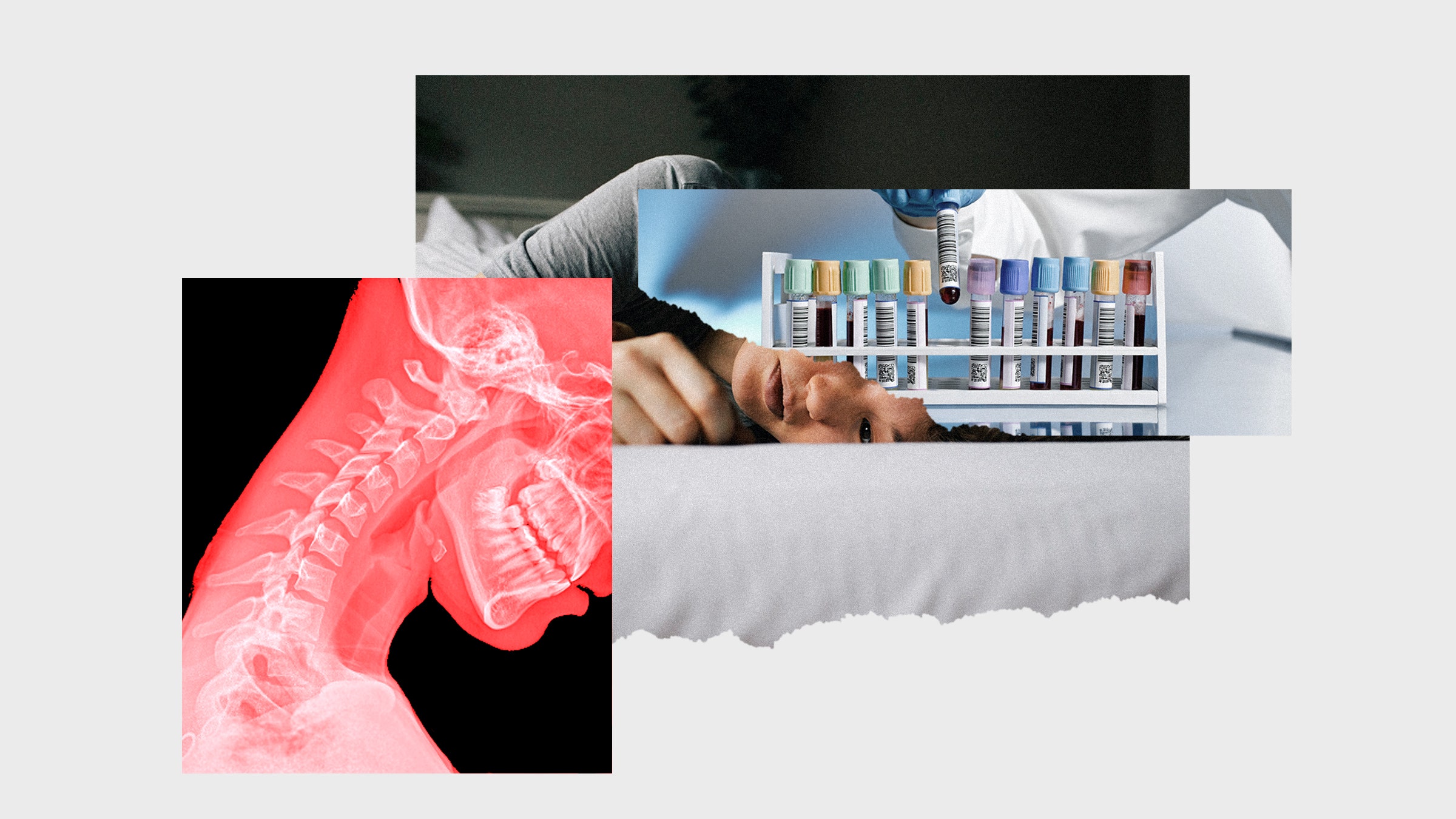 Colagem de imagens de uma radiografia da coluna vertebral de uma pessoa deitada na cama e exames de sangue