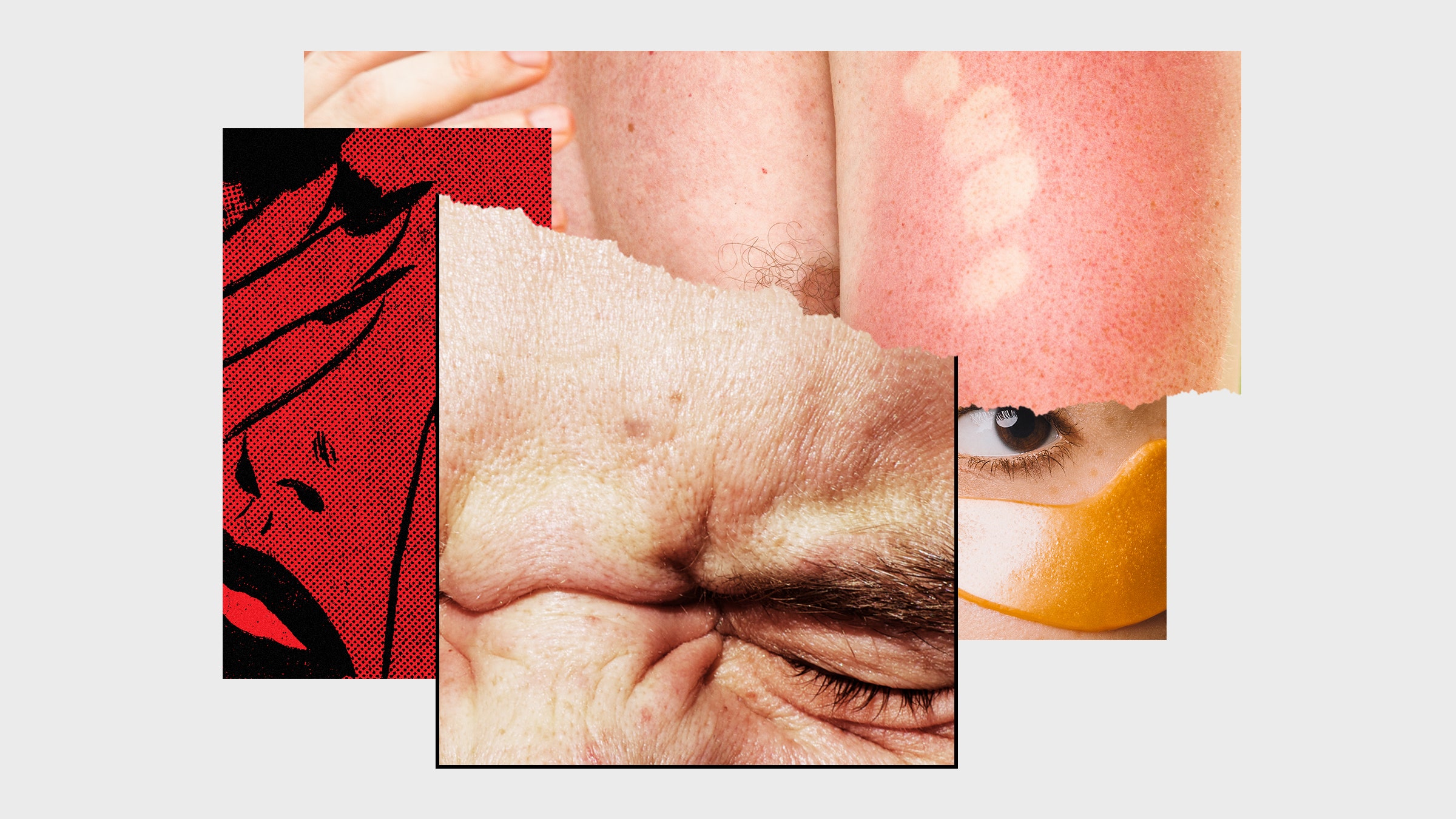 Colagem de imagens de máscaras de pele enrugadas com queimaduras solares