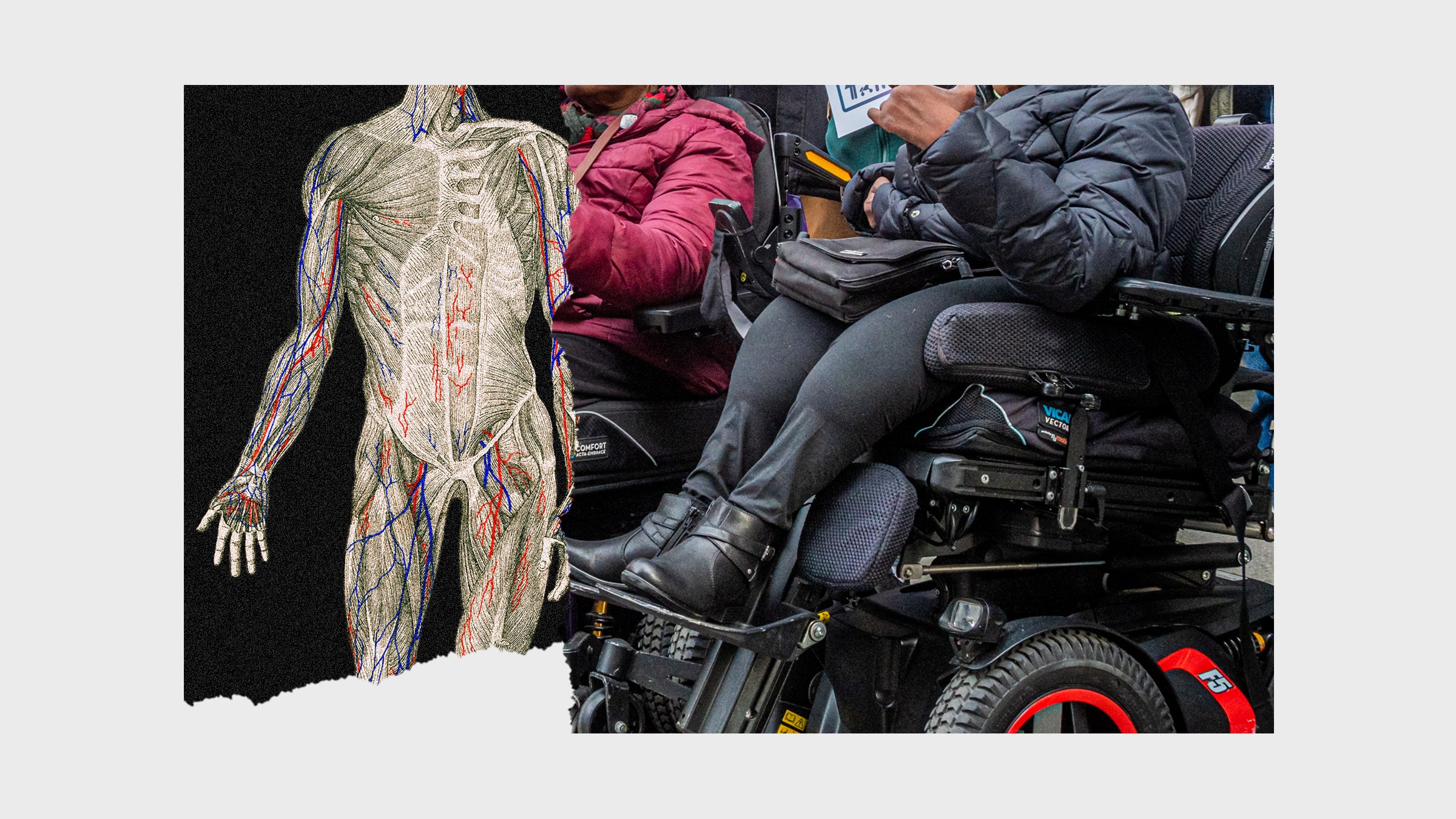 Colagem de imagens de ilustrações anatômicas do homem e do homem em uma cadeira de rodas