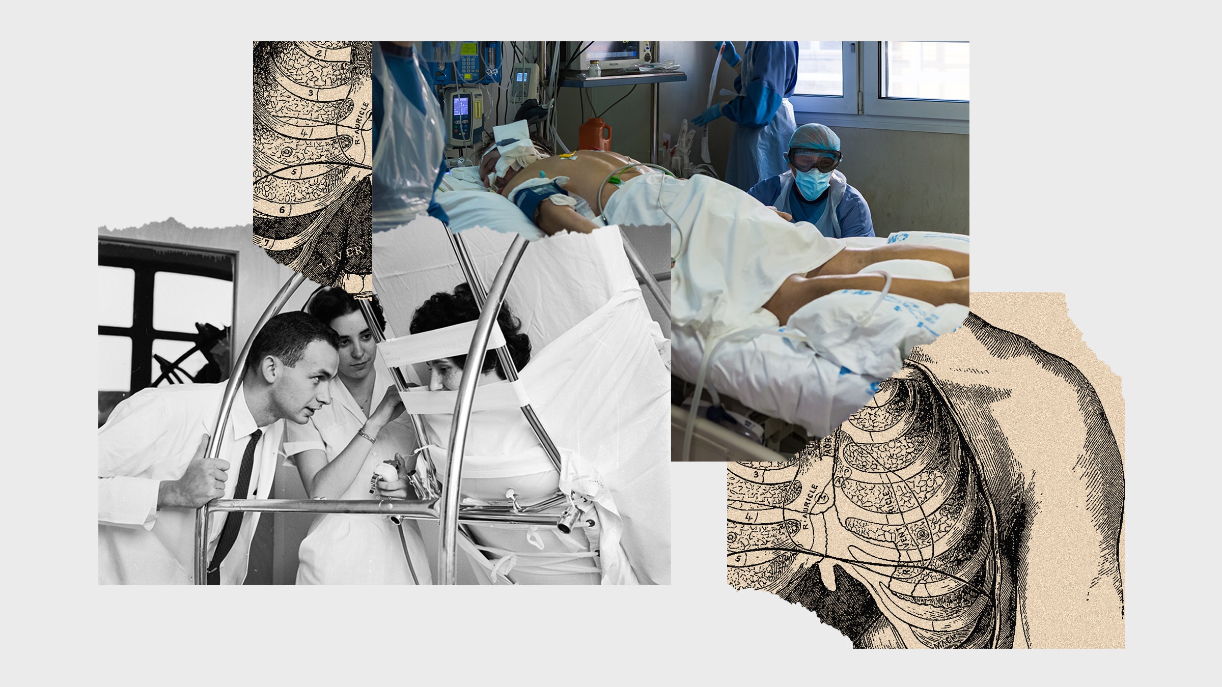 Uma colagem de imagens de um homem deitado de bruços em uma cama de hospital, uma cama redonda girando um paciente e uma imagem anatômica.
